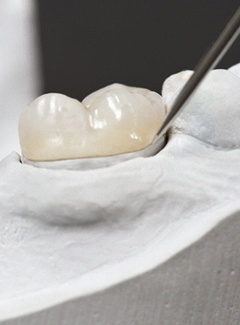 A metal-free dental crown