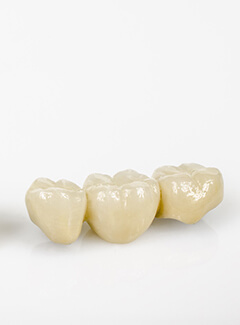 Two Dental Bridges Sitting Side by Side on a White Background