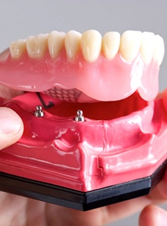 dentist holding a model of an implant denture