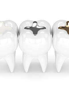 Different types of fillings