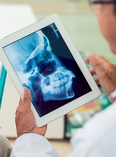 x-ray on tablet