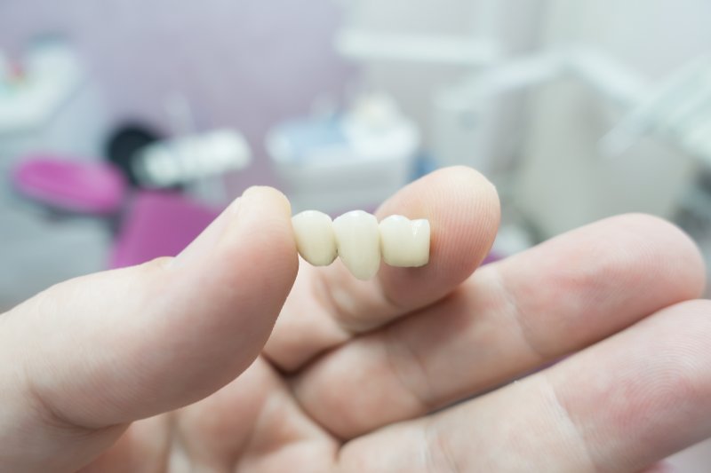 A closeup of a hand holding a dental bridge